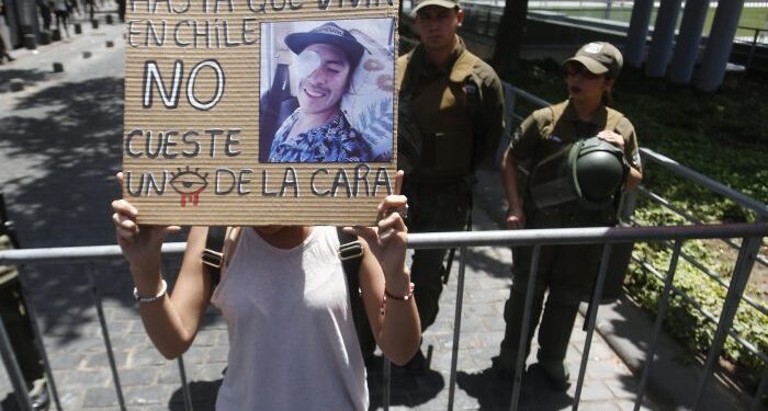 Estudio científico: víctimas con trauma ocular tienen graves dificultades para trabajar y estudiar