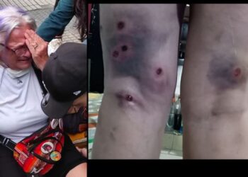 Ana María Tapia de Jubilados Insurgentes: “Seguiremos resistiendo, insistiendo y nunca desistiendo”